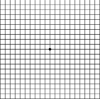 normal ansler grid